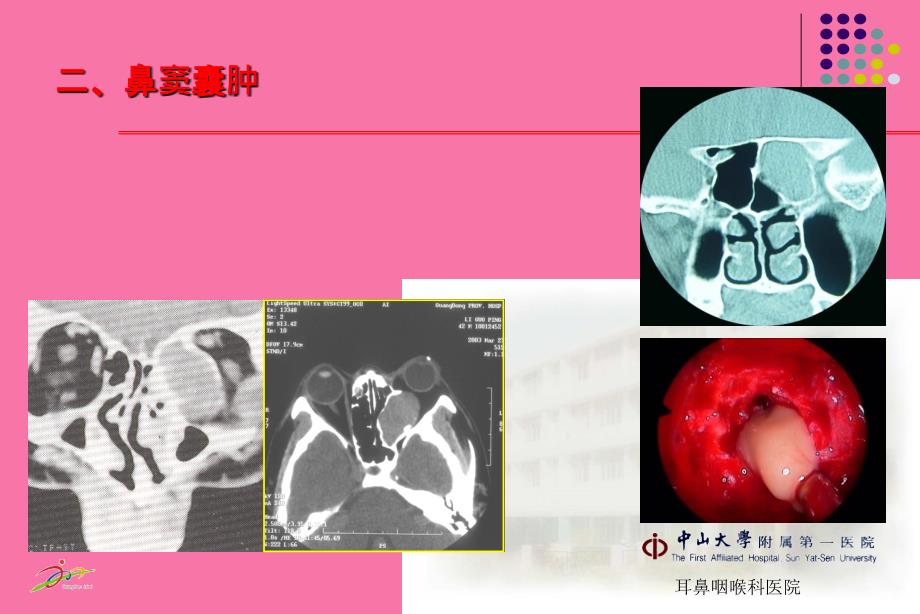 鼻内镜外科技术史剑波ppt课件_第3页