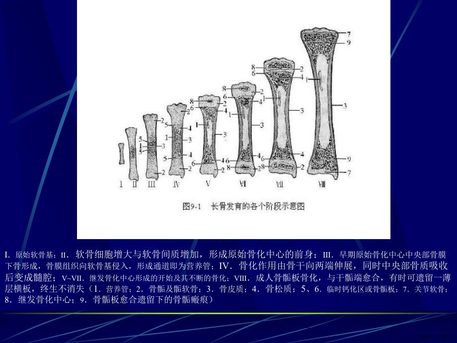 《医学影像诊断学》儿童骨关节发育畸形及股骨头骨骺缺血坏死课件_第3页