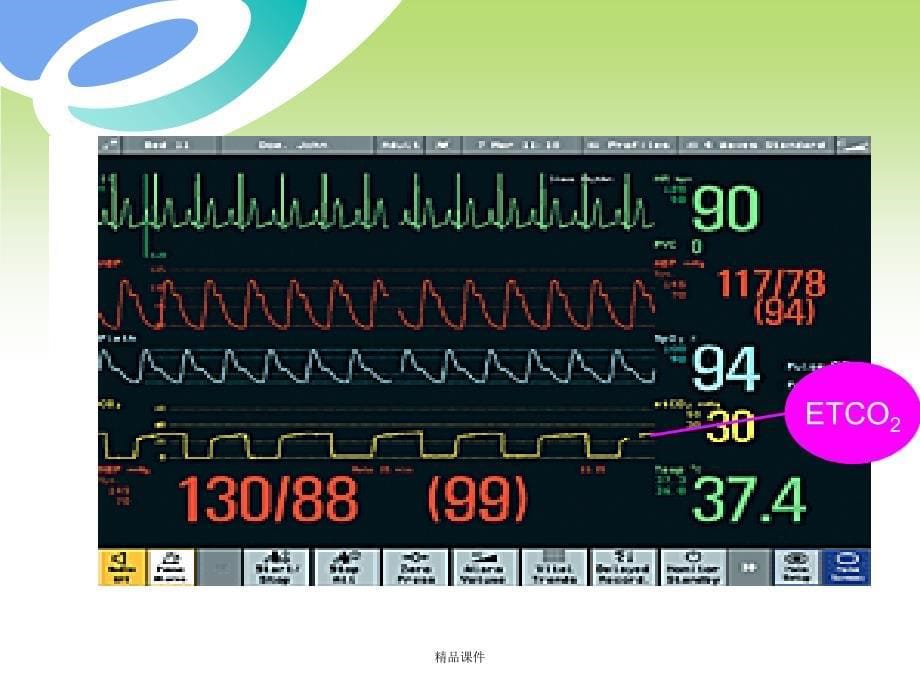 呼气末二氧化碳(ETCO2)监测课件_第5页