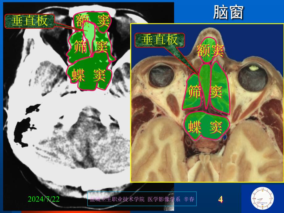 影诊3中枢培训资料_第4页