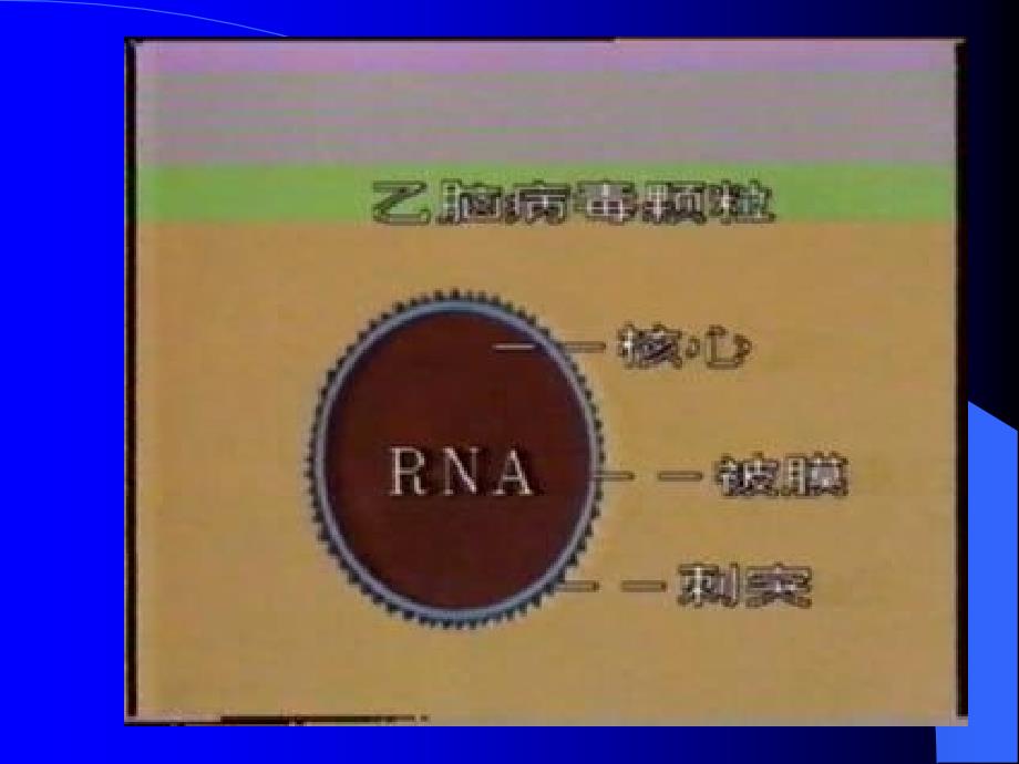 传染病学课件流行性乙型脑炎_第4页