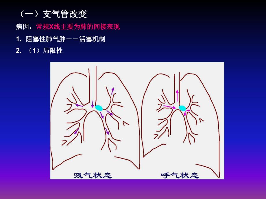 呼吸系统X线基本病变_第2页