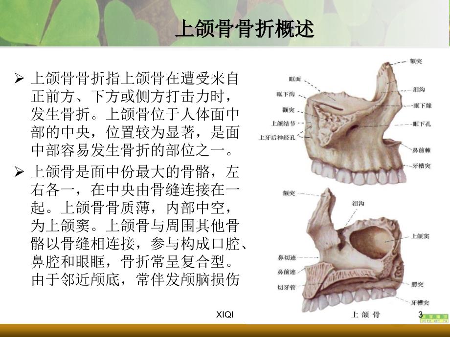 上下颌骨骨折_第3页