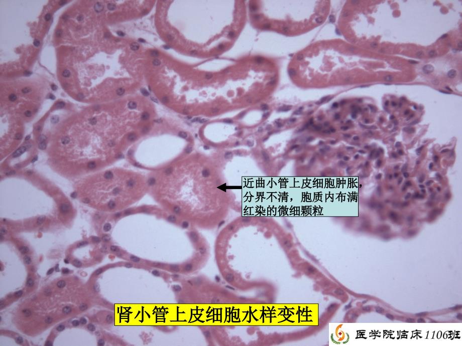 病理学实验总复习(刘勇)_第2页