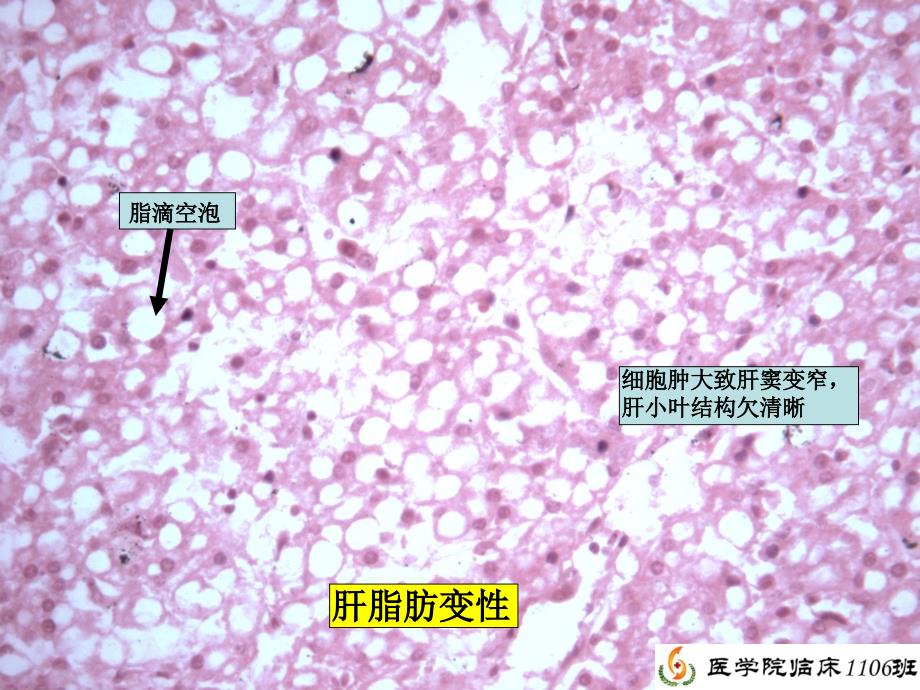 病理学实验总复习(刘勇)_第3页