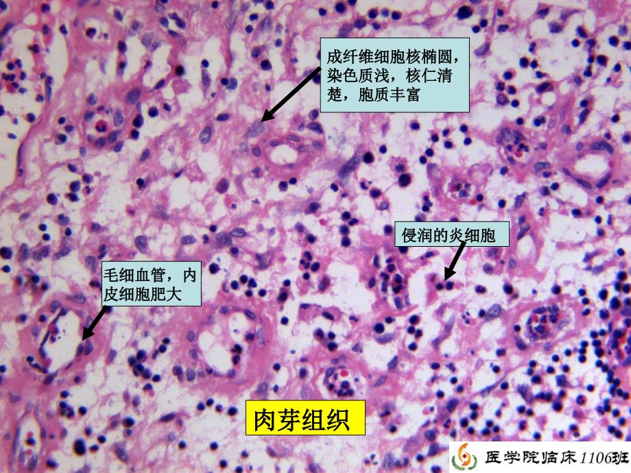 病理学实验总复习(刘勇)_第4页