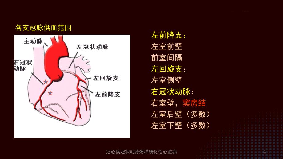 冠心病冠状动脉粥样硬化性心脏病培训课件_第4页