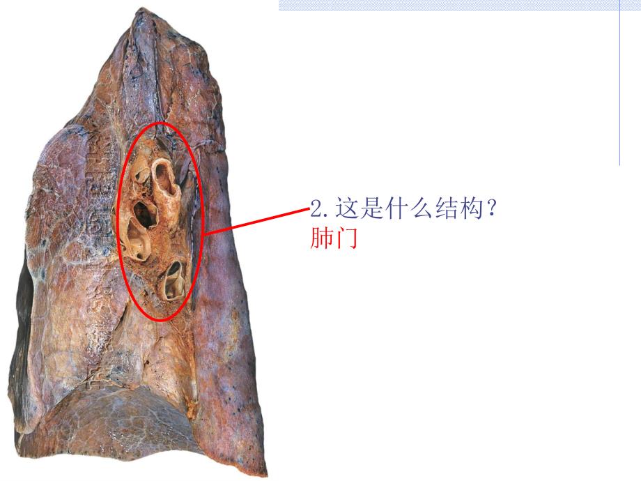 系统解剖学iii级标本考试_第3页