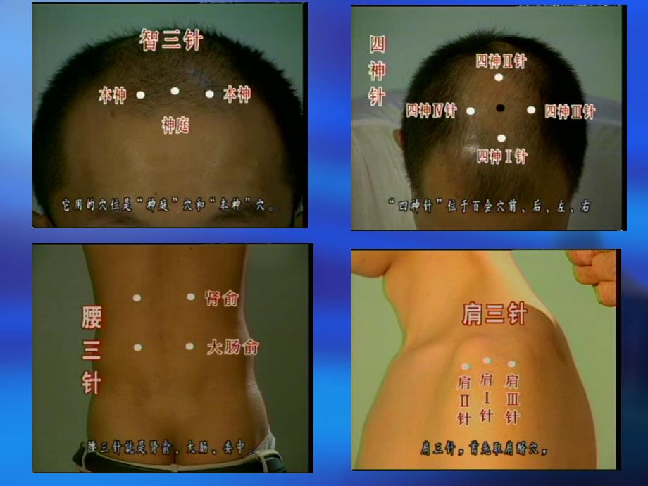 针灸教学课件精选_第1页