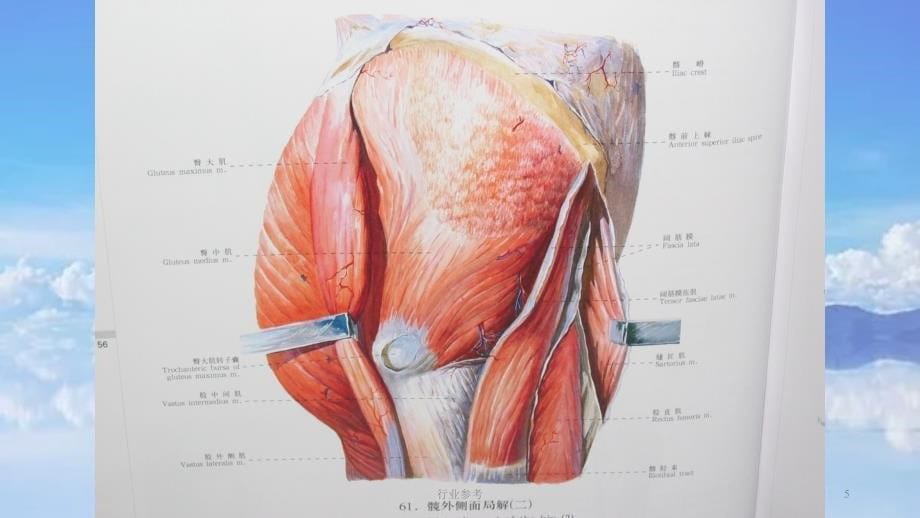臀大肌肌皮瓣课件.ppt【深度讲解】_第5页