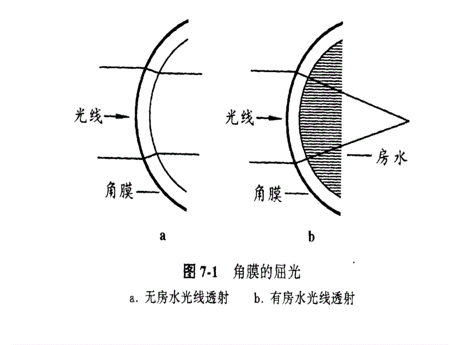 隐形眼镜光学_第3页