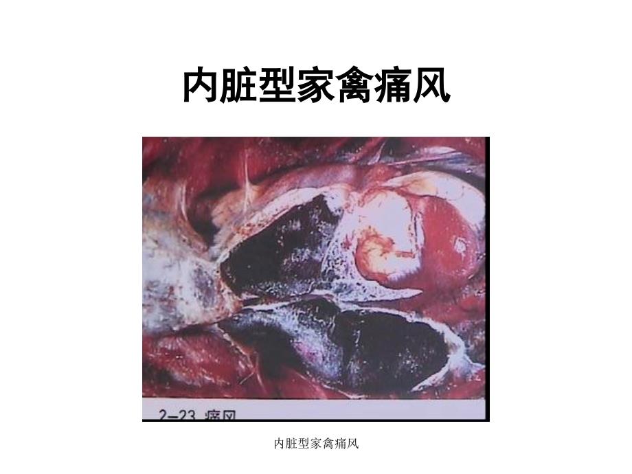 内脏型家禽痛风课件_第3页