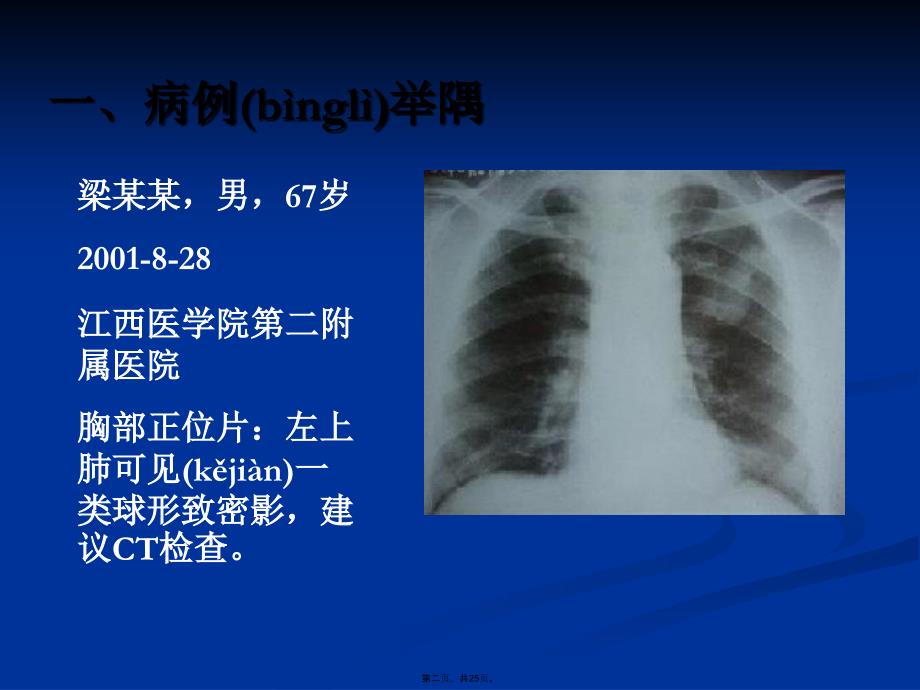 中医治疗肿瘤新策略以肺癌为例复习进程_第2页