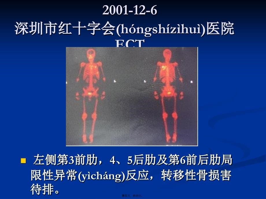 中医治疗肿瘤新策略以肺癌为例复习进程_第5页