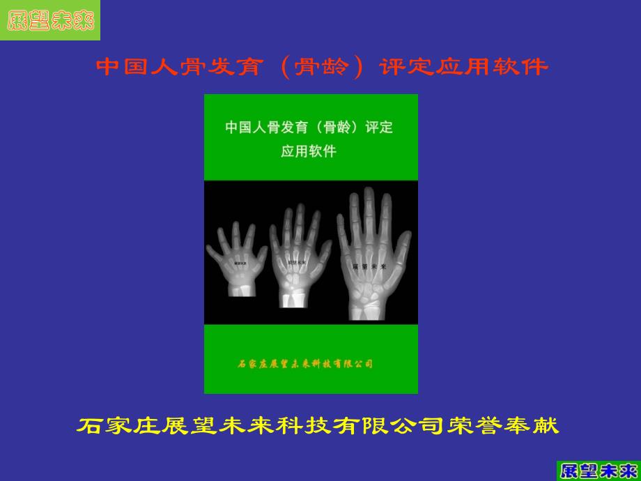 中国人手腕骨发育标准CHN法标准文本及相关资料_第1页