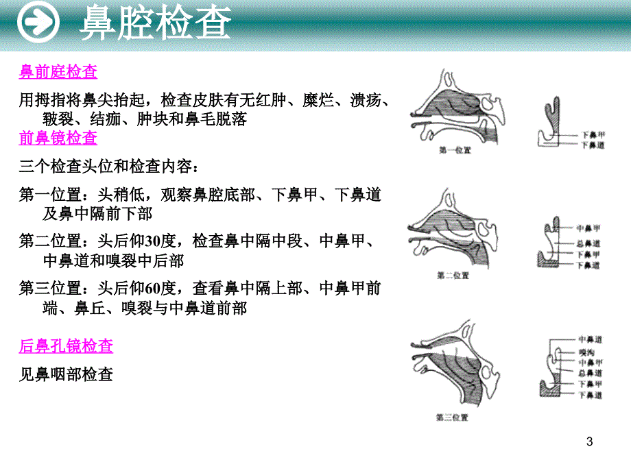 鼻腔鼻窦检查法PPT参考幻灯片_第3页