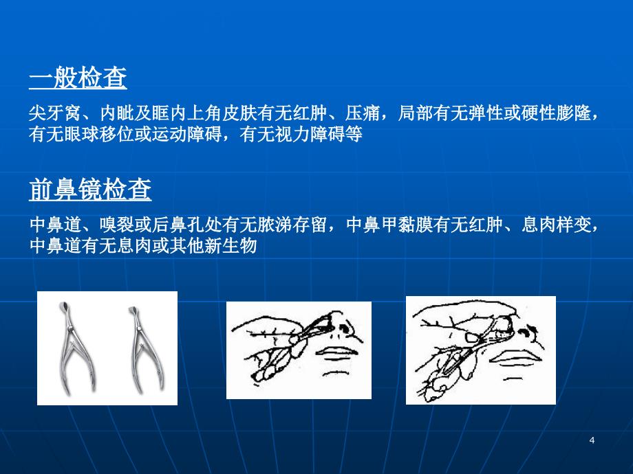 鼻腔鼻窦检查法PPT参考幻灯片_第4页