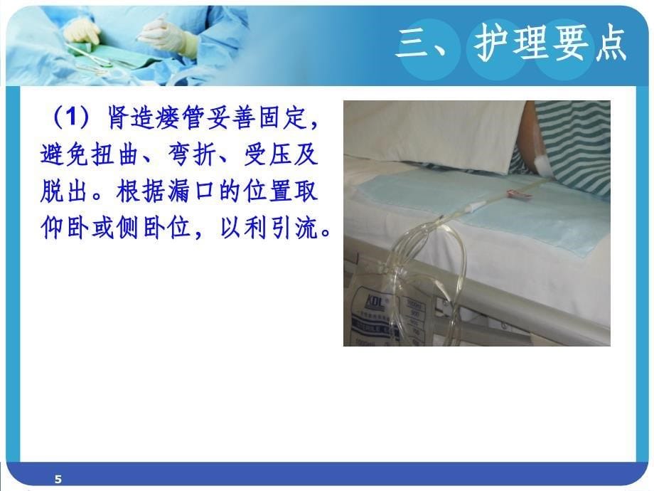 肾穿刺造瘘术的护理.ppt_第5页