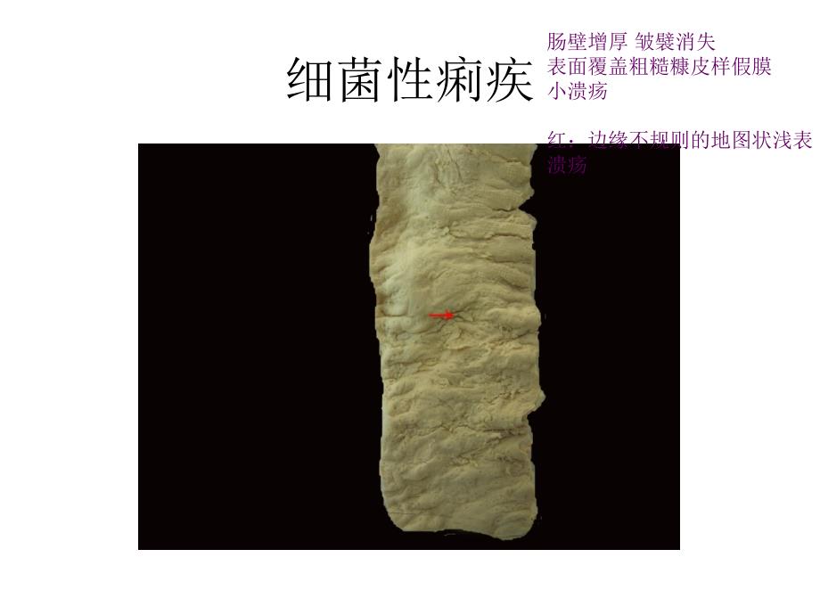 病理图片库：传染与寄生虫病_第1页