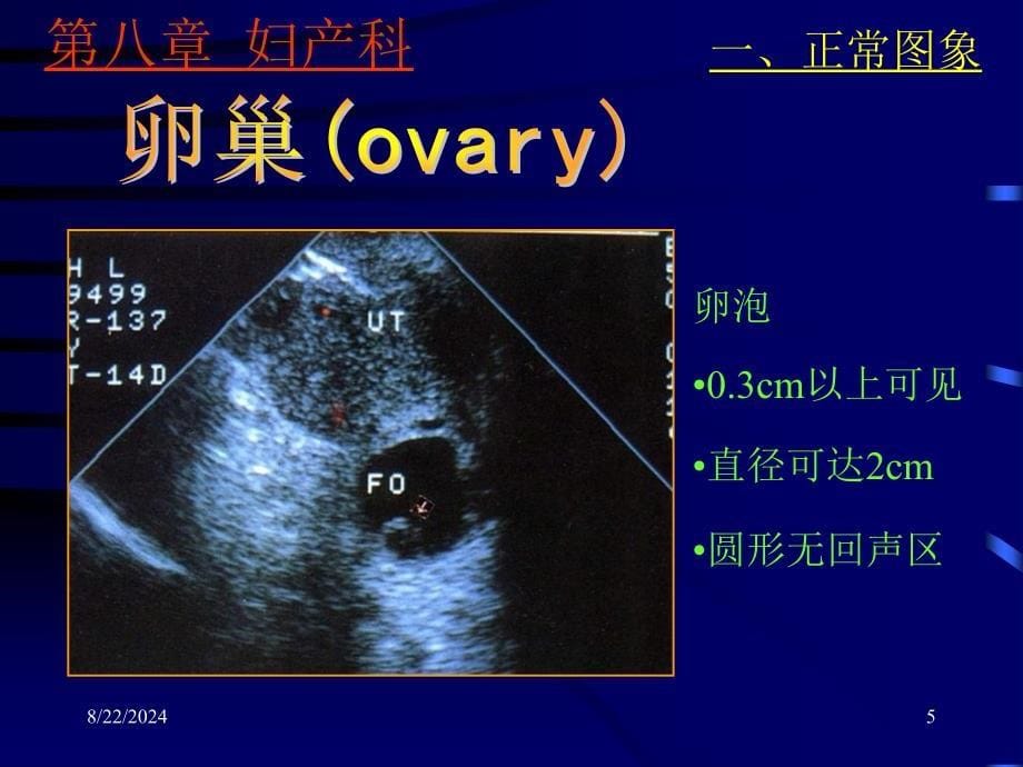 妇产科超声检查PPT文档_第5页