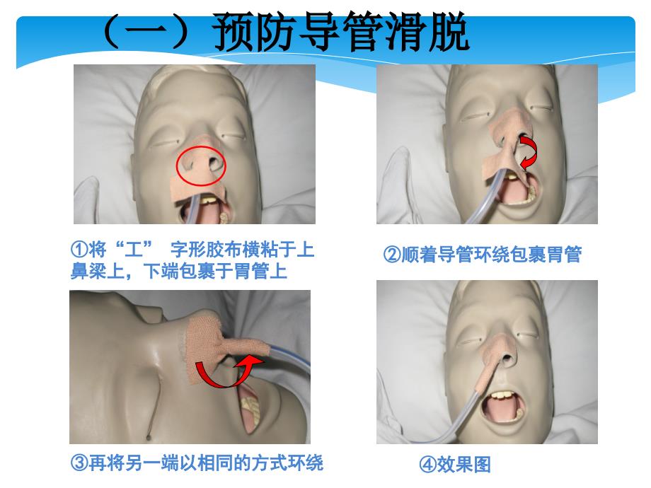 各类导管的护理.ppt_第4页