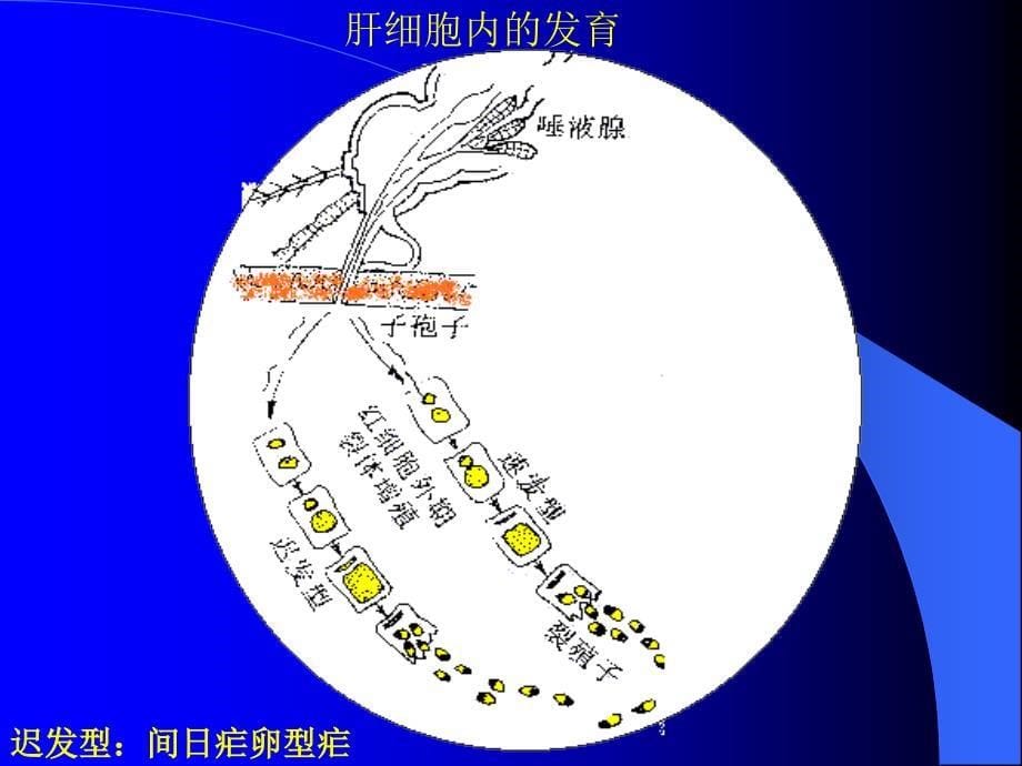 疟疾是由按蚊叮咬传播疟原虫引起的寄生原虫病_第5页