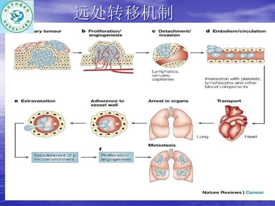 再谈肿瘤外科的无瘤技术和原则_第5页