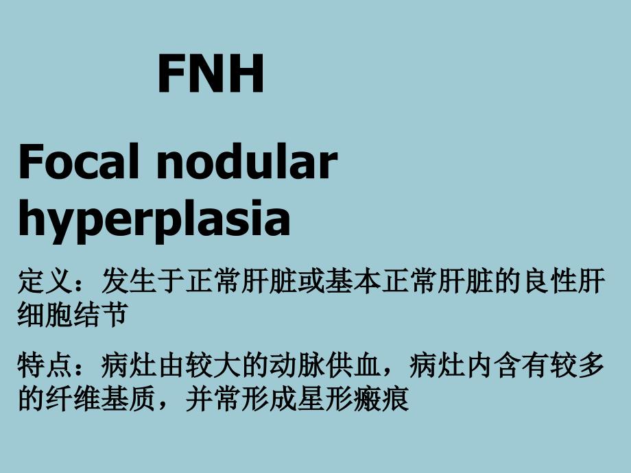 FNH的影像诊断及鉴别诊断_第2页