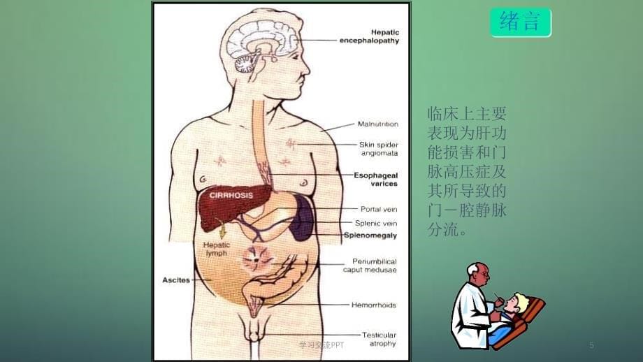 肝硬化治疗的一些进展与共识ppt课件_第5页