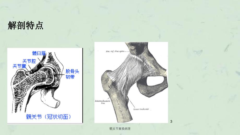 髋关节置换病理课件_第3页