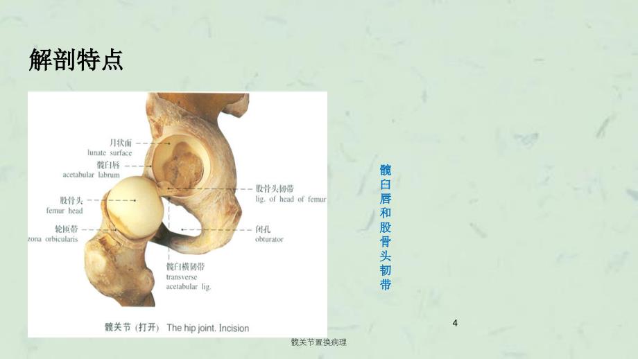 髋关节置换病理课件_第4页