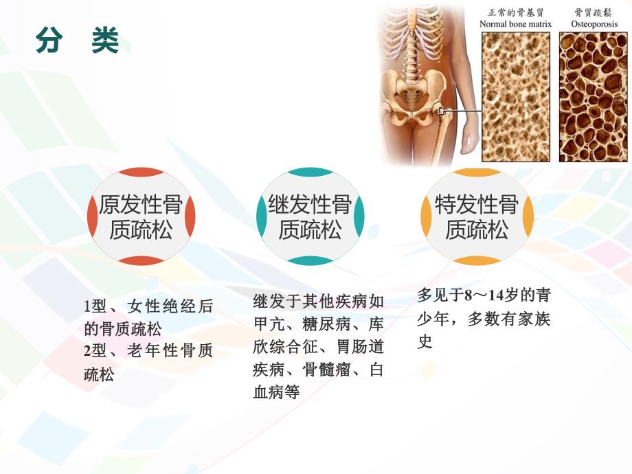 骨质疏松病人的护理课件_第5页