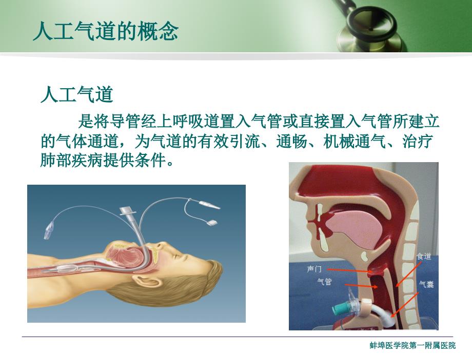 人工气道管理课件.ppt_第2页