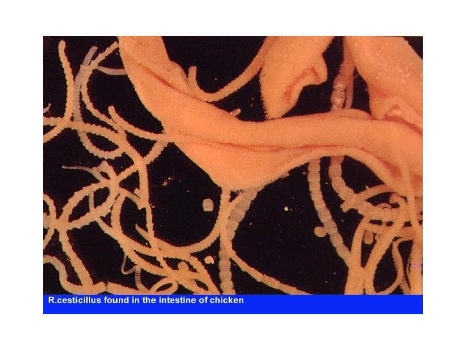 绦虫病 绦虫病_第3页