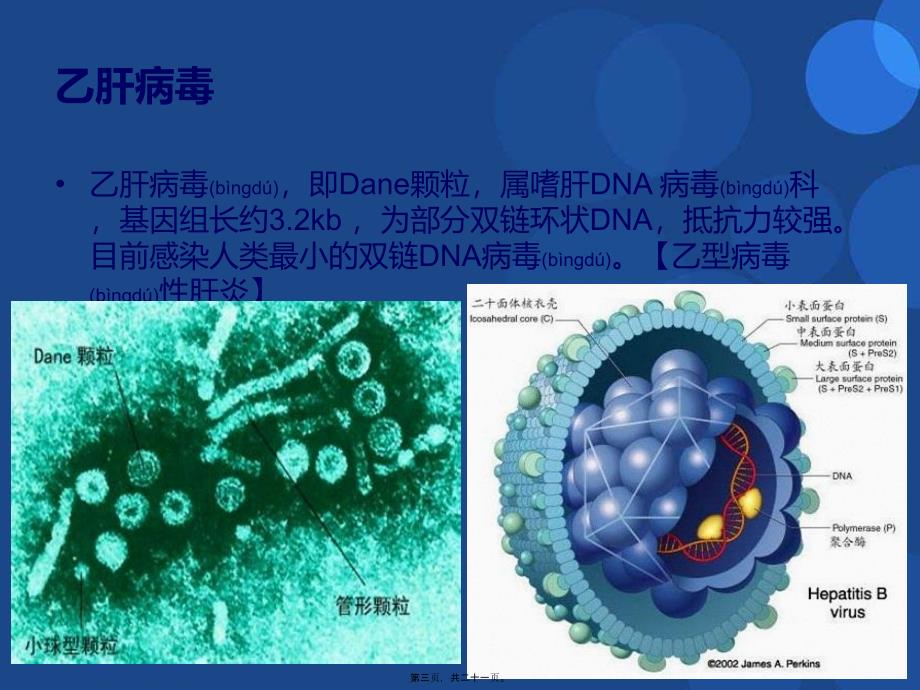 慢性乙型肝炎研究进展课件_第3页