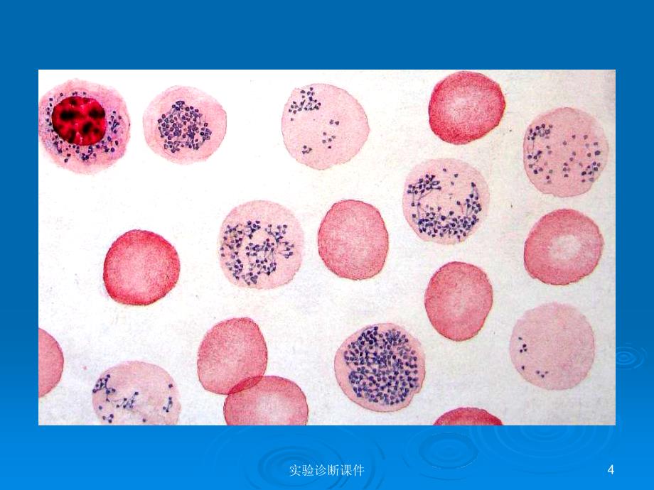 实验诊断课件_第4页
