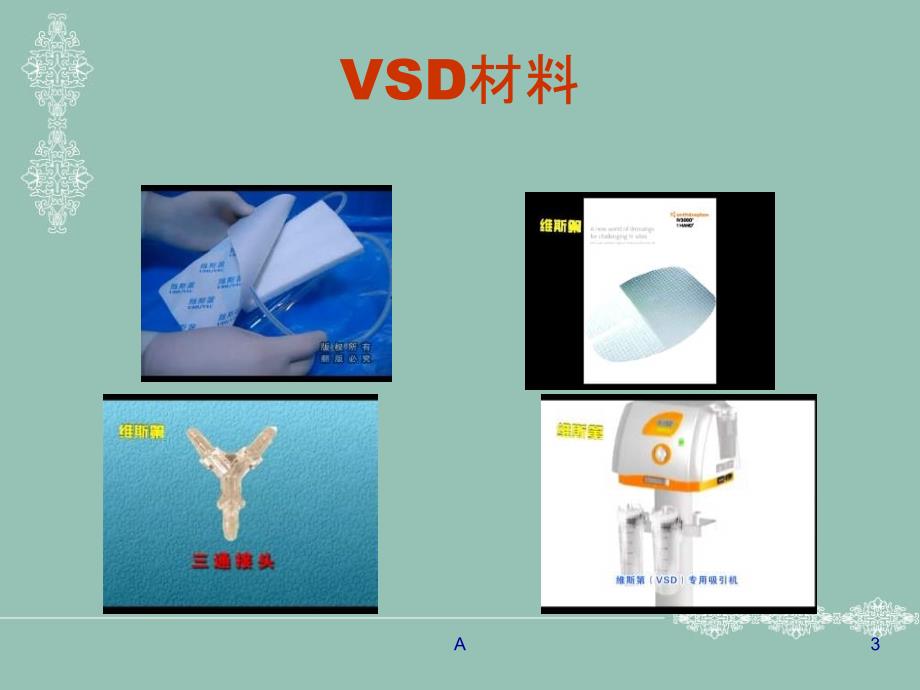 vsd(负压吸引技术)的概述.ppt_第3页