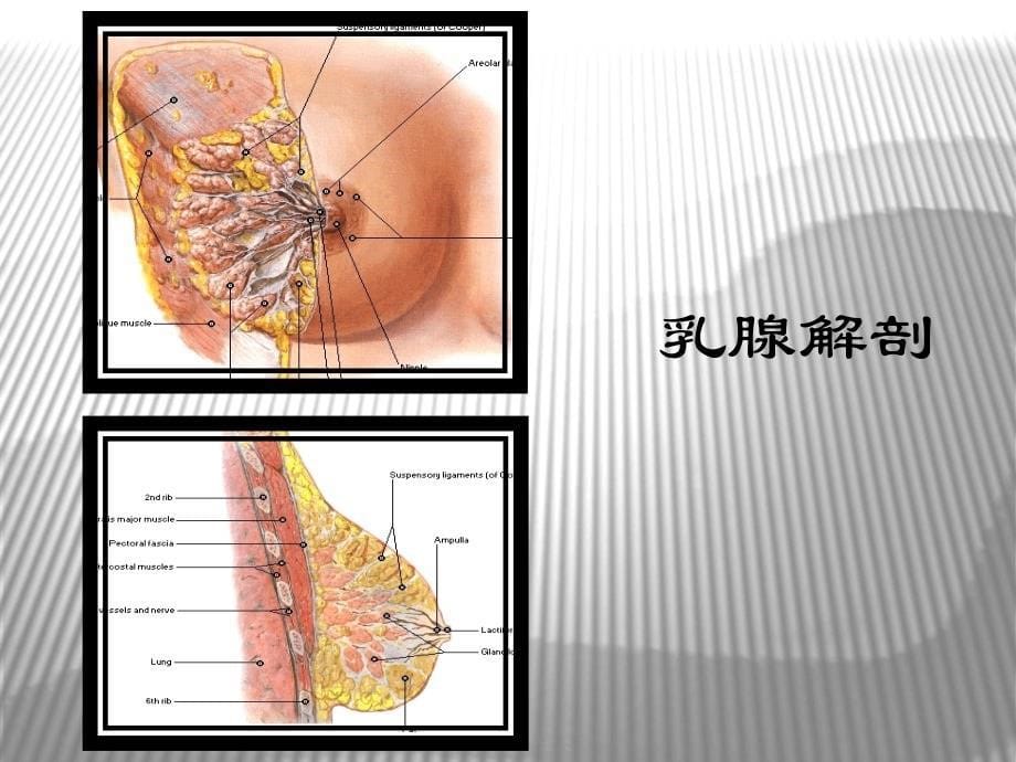 医学影像诊断学课件：乳腺疾病影像学诊断_第5页