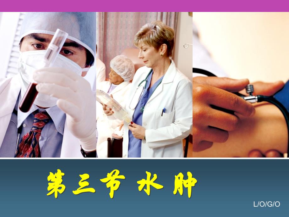 西医诊断学--13.水肿-PPT课件_第1页
