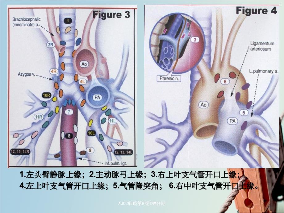 AJCC肺癌第8版TNM分期课件_第4页