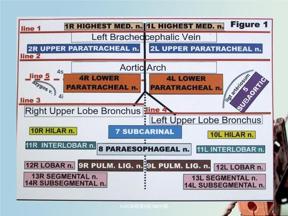AJCC肺癌第8版TNM分期课件_第5页