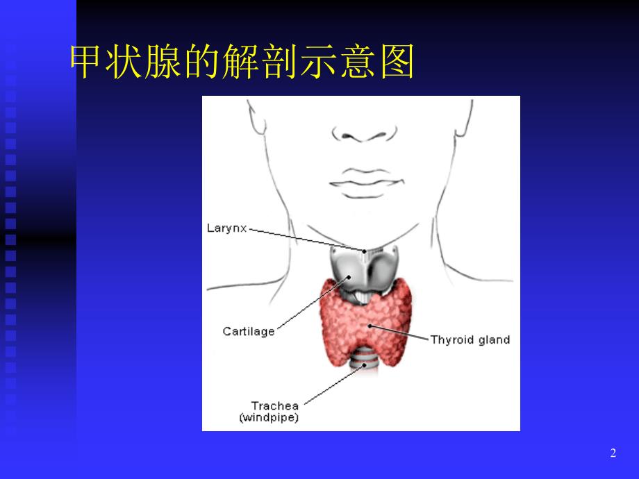 桥本病讲稿2课件_第2页