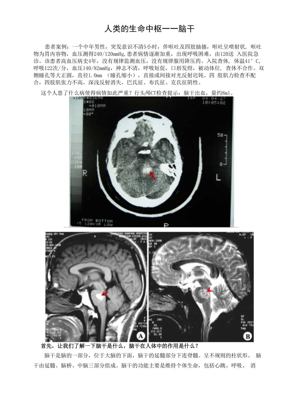 人类的生命中枢——脑干_第1页