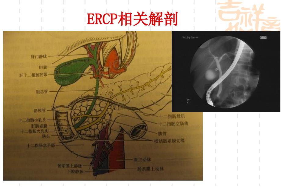 ERCP业务学习_第4页