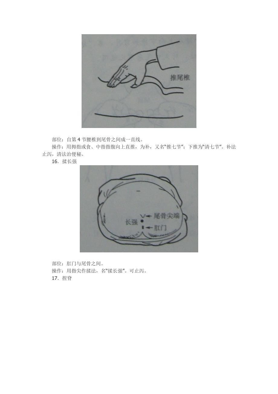 火柴棒医生周尔晋小儿推拿法.doc_第5页