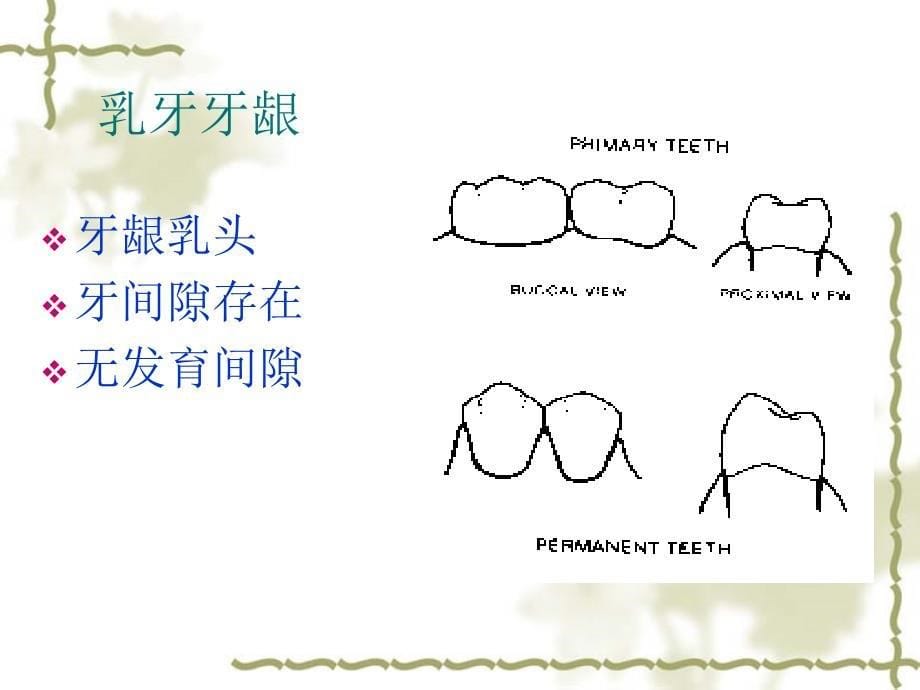 儿童口腔牙周粘膜组织疾患-口腔科教学课件_第5页