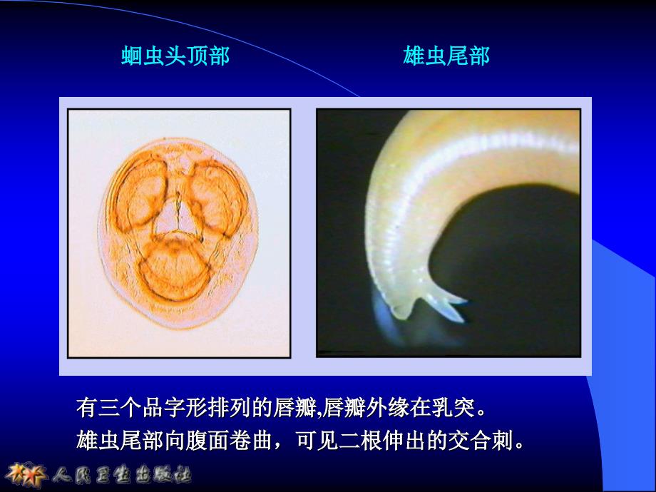 寄生虫似蚓蛔线虫_第4页