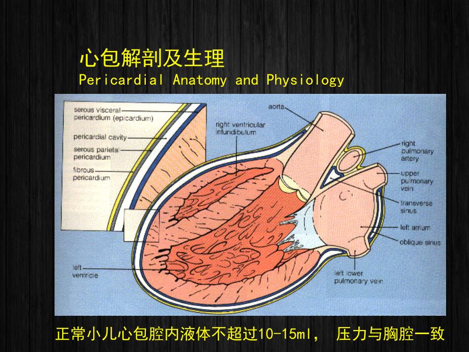 急性心包炎ppt课件1_第3页