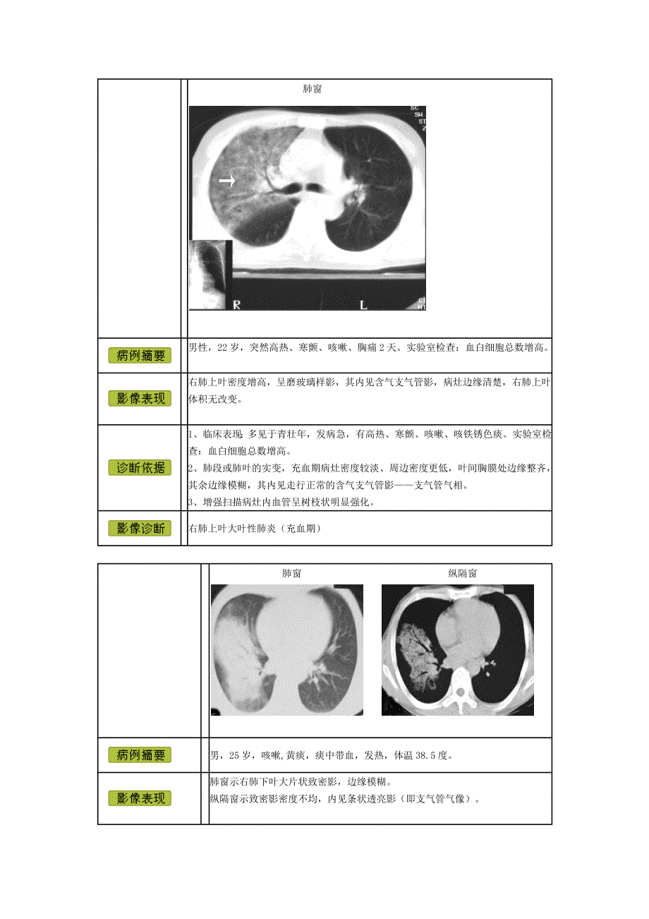 CT学习：图片解析及疾病诊断.doc_第1页