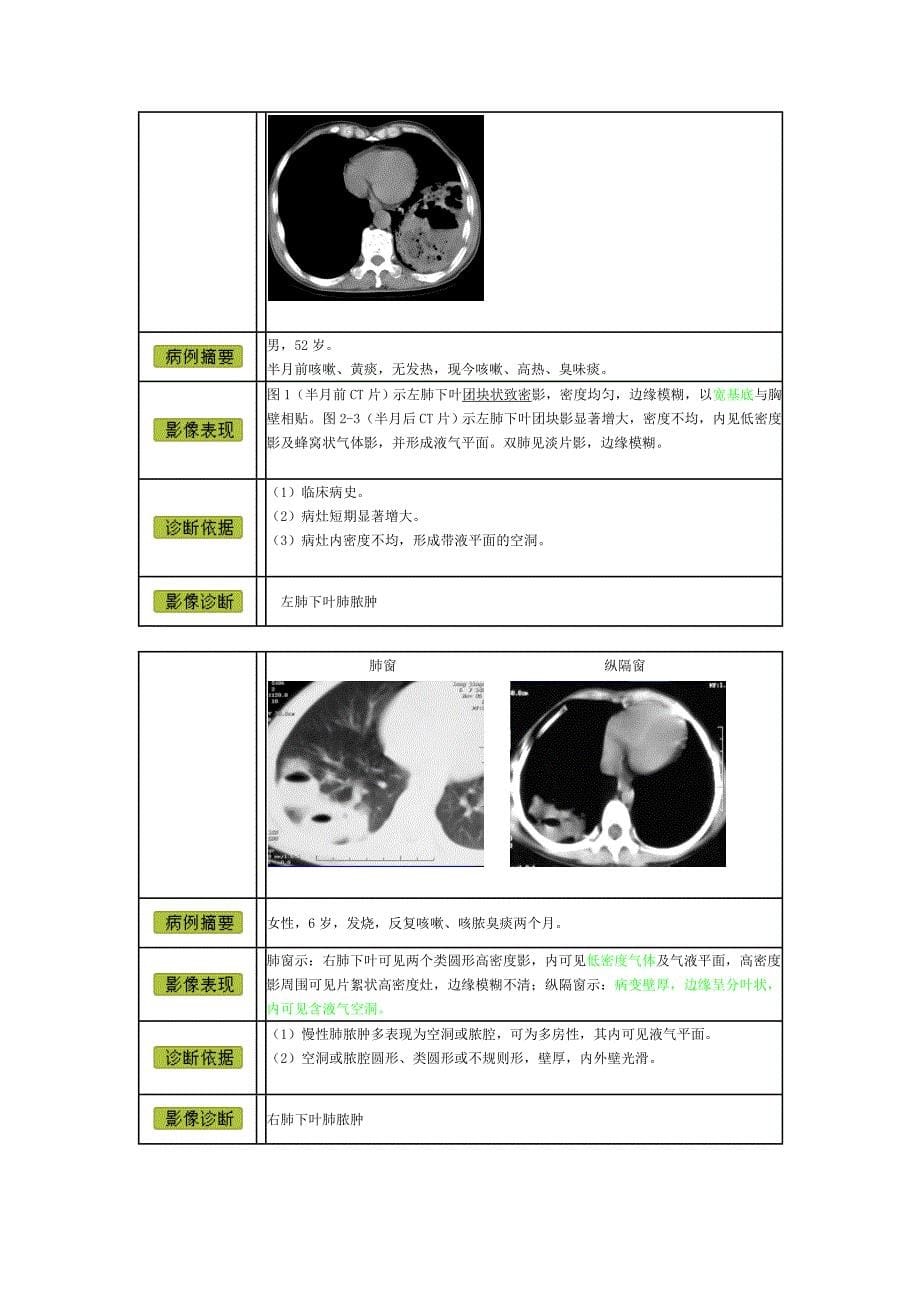 CT学习：图片解析及疾病诊断.doc_第5页